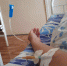 Полтора литра гноя откачали из живота женщины в Нижегородской области - фото 1 - vGorodeN.Ru